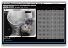 CRIL study case display